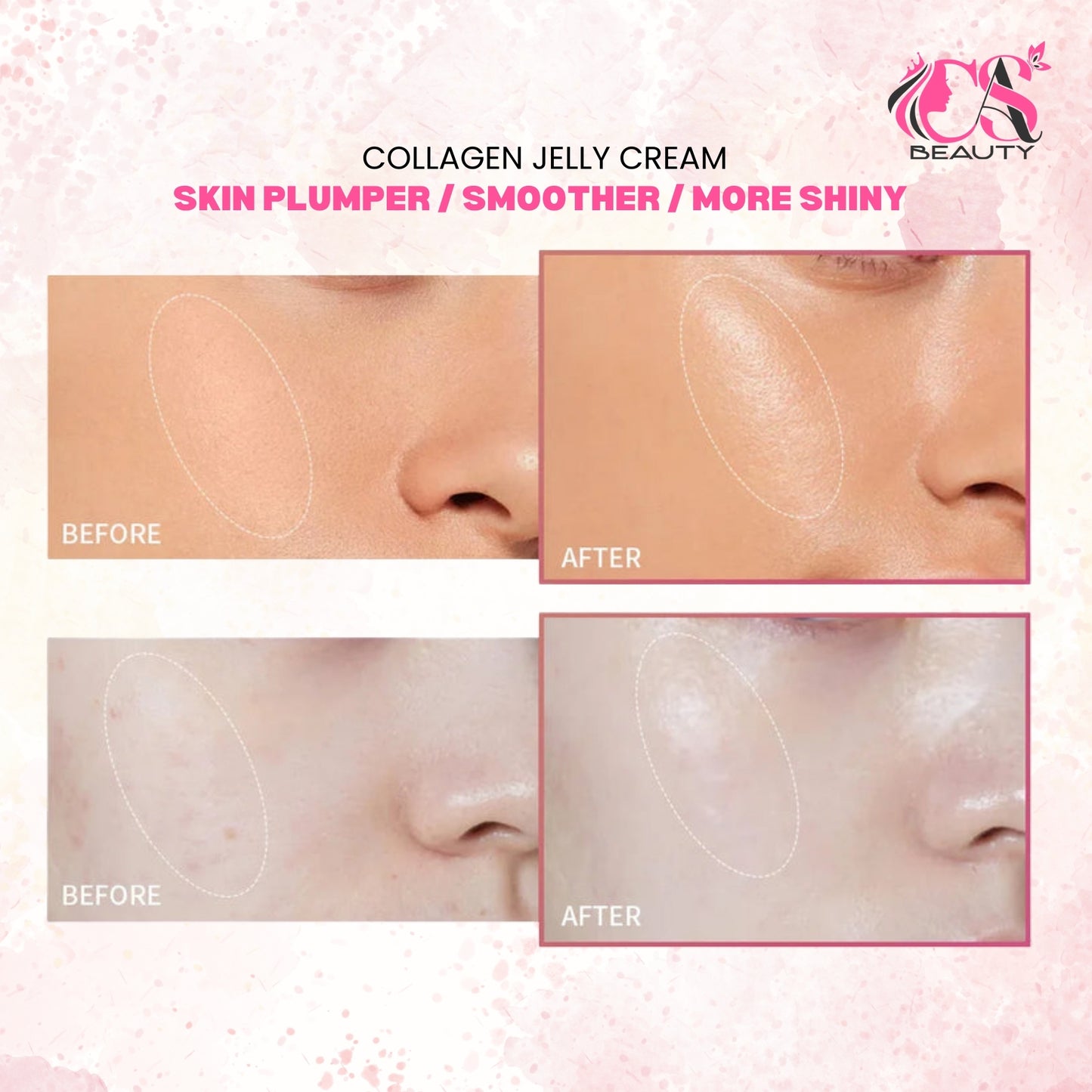 Cas Beauty™ Jelly