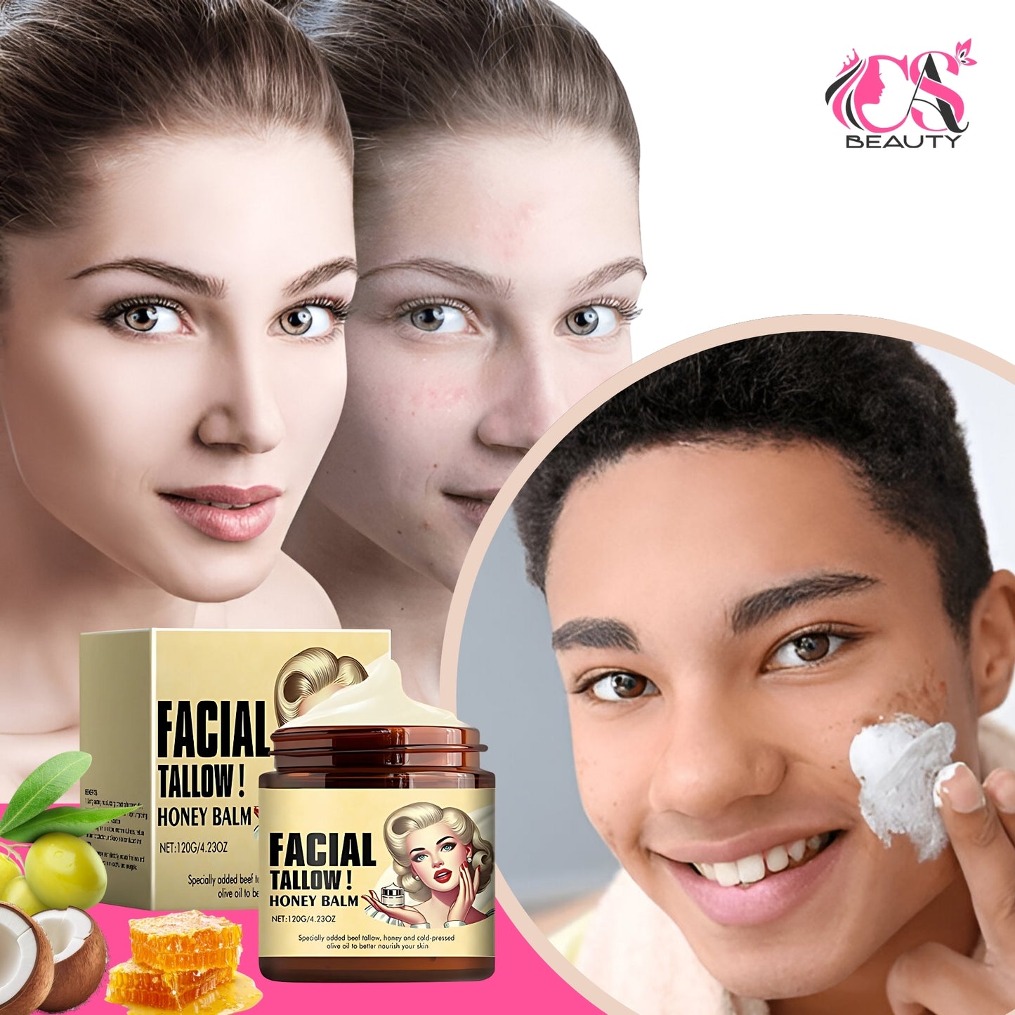 Cas Beauty Balm – Whipped beef tallow and honey face moisturizer for deep hydration and skin nourishment. Grass-fed, grass-finished skincare for face and body